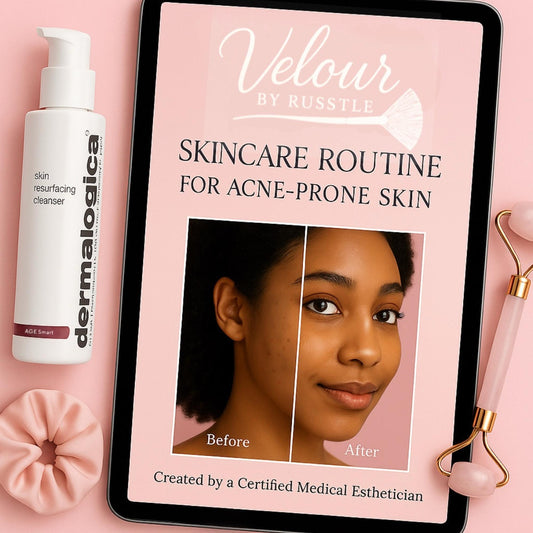 Acne Skincare Routine | Digital Guide for Oily & Acne-Prone Skin | Esthetician-Approved | AM/PM Routine + Tracker